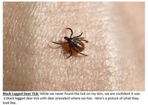 Black Legged Deer Tick Example